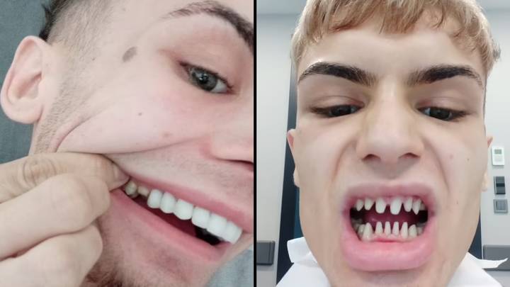 Man complains he 'looks like a shark' after spending thousands on new teeth in Turkey